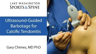 Ultrasoundguided Barbotage for Calcific Tendinitis [upl. by Ytsihc]