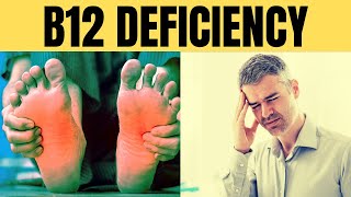 Vitamin B12 deficiency symptoms  Vitamin B12 foods  Increase vitamin B12 naturallyVitamins B12 [upl. by Ardnnek]