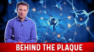 What is Plaque and How to Remove it Explained By Dr Berg [upl. by Alburg]