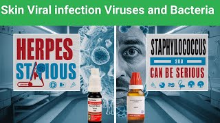 Skin viral infection  Bacterial growth  staphylococcus  Chickenpox Harpers  heart diseases [upl. by Mode]