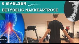 6 Øvelser mot Betydelig Nakkeartrose [upl. by Vogele]