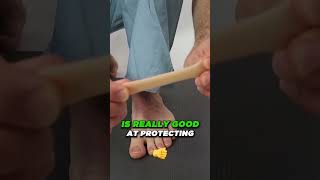 Do bunions HURT  how to help a bunioN [upl. by Seda]