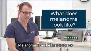 What does melanoma look like [upl. by Abroms]