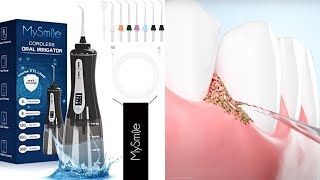 MySmile Cordless Advanced OLED Water Flosser [upl. by Xenia]