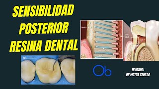 Sensibilidad Posterior a Resina Dental 🦷 [upl. by Matthei272]