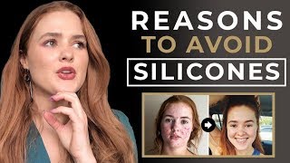 Why You Need to Avoid Silicone on Skincare [upl. by Ynohtnaluap]