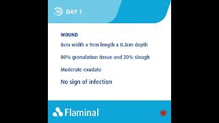 Case report  treatment of a venous Leg Ulcer with Flaminal® [upl. by Revert]