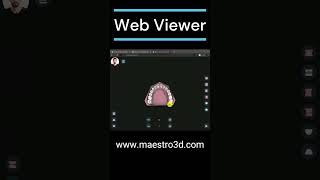 Maestro 3D  Dental Studio  WebViewer [upl. by Rehpotsyrk927]