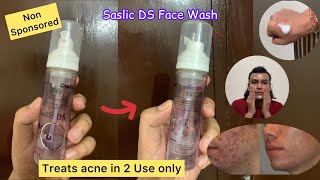 Saslic DS Face Wash Review  Saslic Foaming Face Wash Review [upl. by Lemhaj]