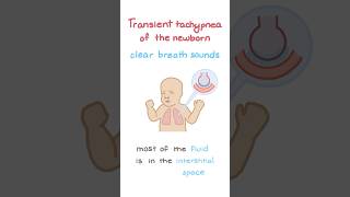 Transient tachypnea of the newborn TTN [upl. by Aon]