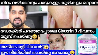 ഞെട്ടിച്ചു കളഞ്ഞു Glycerin😮Use glycerin daily for Amazing Results💯Shilpa sanjay glycerin [upl. by Sunda]