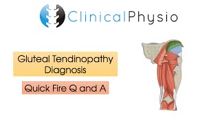 Classic Gluteal Tendinopathy Diagnosis  Clinical Physio [upl. by Ryley]