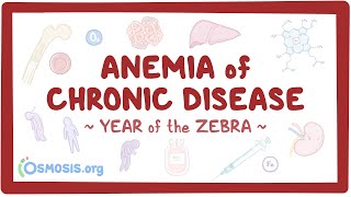 Anemia of chronic disease Year of the Zebra [upl. by Soutor]