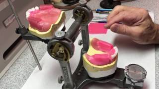 Posterior Denture Tooth SetUp Lingualized Occlusion [upl. by Enilegna619]