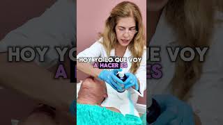 Drenaje Linfático Facial después de Lipo con Transferencia y JPlasma  Parte 1  Bye2Hair [upl. by Nereil47]