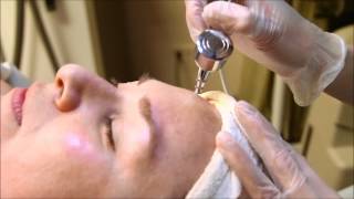 Intraceuticals Oxygen Treatment at True Skin Care Center [upl. by Bourque]