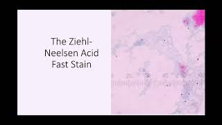 ZiehlNeelsen Acid Fast Stain [upl. by Paulie]