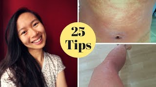 HOW I CURED MY ECZEMA [upl. by Morgan]