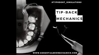 TipbackwithTPA  Essential Biomechanics [upl. by Siroval]