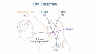 EBV and Mononucleosis  Pathogenesis and Clinical Presentation [upl. by Mirielle]