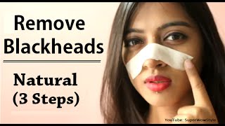 How to Remove Blackheads From Nose amp Face  Naturally at Home  Superwowstyle [upl. by Serica223]