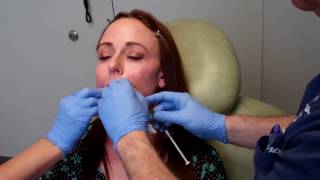 PRFM Advanced PRP for facial rejuvenation with Dr Janowski [upl. by Hube]