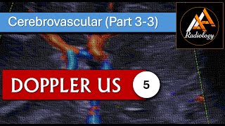 5  Cerebrovascular System Part 33 [upl. by Sredna]