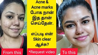 How I cleared my acne  My skincare routine for Acne amp Acne marks  Best products for pimple skin [upl. by Carol-Jean]