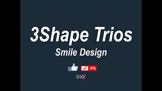 DIO 3shape Smile design [upl. by Stclair221]