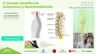 ACUPUNTURA en el tratamiento de la CERVICALGIA  Prof Raúl Rubio  CampusAcupuntura [upl. by Yecram]