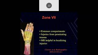 MRI of the Wrist Part 8  Wrist Tendons [upl. by Sumerlin]