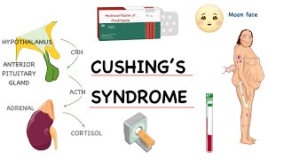 ‎⭕ شرح مفصل خطوة بخطوة لـ  Pathophysiology of Cushing’s Syndrome [upl. by Hussein397]