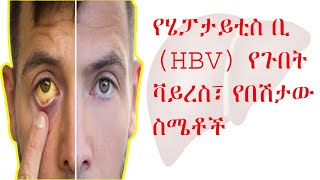 የሄፓታይቲስ ቢ HBV የጉበት ቫይረስ፣የበሽታው ስሜቶች Symptoms of HBV Infection [upl. by Etnaled231]