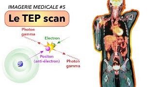 IMAGERIE MEDICALE 5  Le TEP scan [upl. by Thilda411]