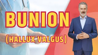 What is BUNION Hallux Valgus The Truth About Bunions [upl. by Bishop]