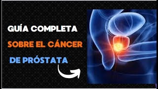 quotGuía Completa sobre el Cáncer de Próstata Factores de Riesgo y Prevenciónquot [upl. by Goldfarb210]