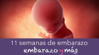 11 semanas de embarazo  Tercer mes  EMBARAZOYMAS [upl. by Seidnac262]