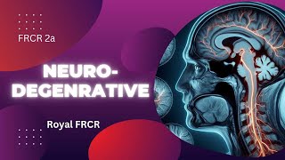 5  Neuroimaging for FRCR [upl. by Gnel]