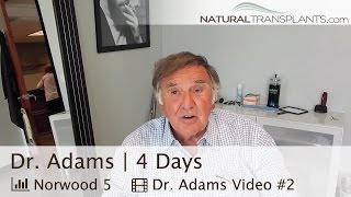 Hair Transplant Fort Myers Followup  Best Hair Replacement Surgery in Florida Dr Adams [upl. by Retsevlis]