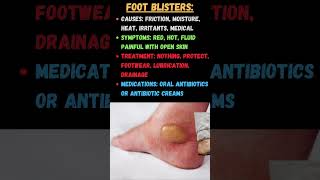 How To Prevent And Treat Foot amp Toe Blisters [upl. by Llertal10]