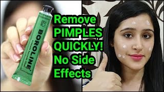 Remove PIMPLES amp ACNE IN 3 DAYS  NATURAL amp EASY METHOD [upl. by Atikan601]