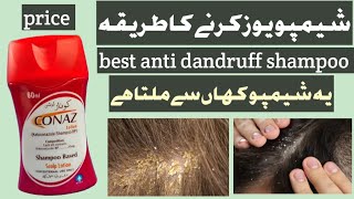 Conaz anti dandruff shampoo reviewhow to use conaz anti dandruff shampoo [upl. by Nomannic462]