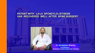 Patient with L4L5 spondylolisthesis is back to normalcy after successful spine surgery [upl. by Lamb705]