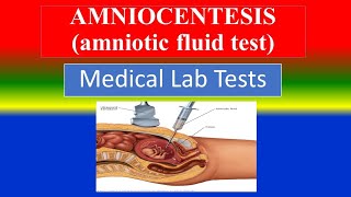 AMNIOCENTESIS amniotic fluid test   What is  Uses  Need  Risk  Preparation Results [upl. by Ferdie]