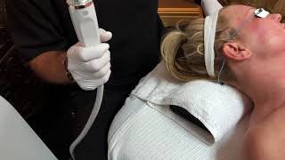 Rick McCoy explains the EndyMed 3Deep RF Microneedling skin tightening treatment at Cascades MedSpa [upl. by Yekcir]