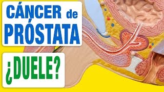 Cáncer de Próstata y Dolor [upl. by Yerffoj]