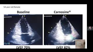 How Carnosine Benefits the Heart [upl. by Nylarad]