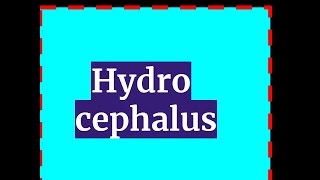 HYDROCEPHALUS [upl. by Candless]