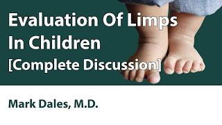 Evaluation Of Limps In Children Complete Discussion [upl. by Derreg]