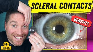 The Amazing Benefits Of Scleral Contact Lenses [upl. by Bertie522]